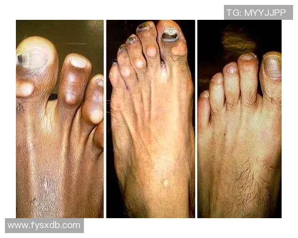 踢足球崴脚的球星们伤情回顾及对职业生涯的影响分析